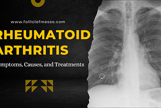 Rheumatoid Arthritis, health tips, health issues