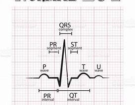 ELECTROCARDIOGRAPHY(ECG): VARIATIONS IN VARIOUS CONDITIONS-