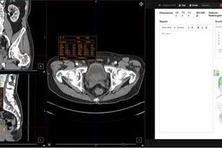 Federated Learning to support Diagnostic Imaging for next generation AI-powered healthcare​