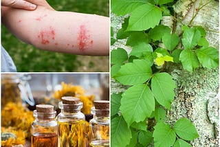 Home Remedies for Poison Ivy: Soothe Itching and Rashes Naturally