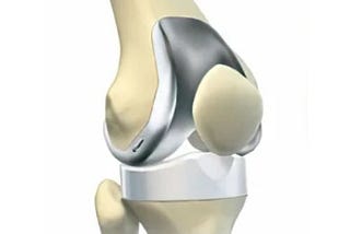 Comprehensive Knee Replacement ACL Reconstruction at YK Orthopaedics