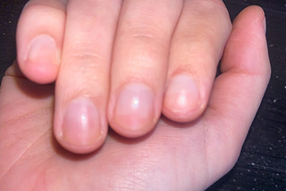 What I Learned When I Grew My Nails Out