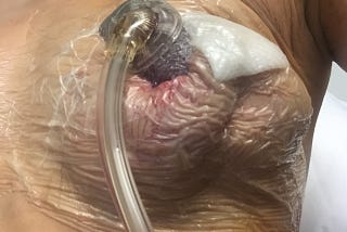 What to do when your boob explodes at 35,000 feet…