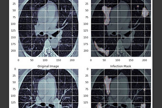 COVID-19 Infection and Lung Segmentation using CT Scans