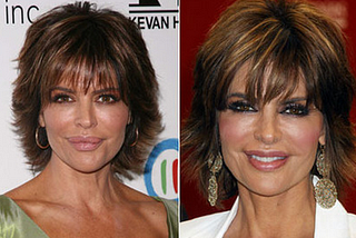 Lisa Rinna Plastic Surgery Insight