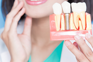 Dental Implants Surgery