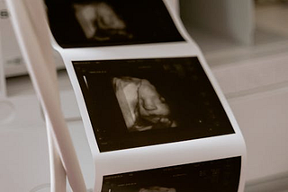 A Guide to 3D & 4D Ultrasound: Capturing Your Baby’s First Moments