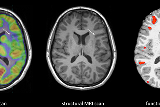 What Do We Know About Our Brain Interactions?