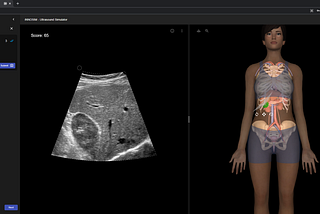 A new web-based ultrasound simulator to significantly improve students psychomotor skills requisite…