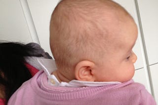 What happens if the plagiocephaly helmet doesn’t seem to be working?