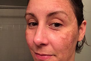 Life After Addiction: Skincare update #1