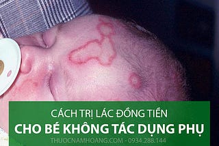 [Hot] Nơi mua thuốc trị Lác đồng tiền cho Trẻ Sơ Sinh không kích ứng da 2018