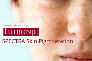 Laser Treatment for Skin Pigmentation Removal in Singapore- Lim Clinic and Surgery.