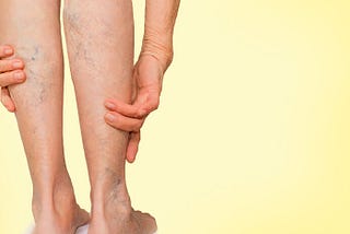 Chronic Venous Ulcer Treatment — Pedes Orange County