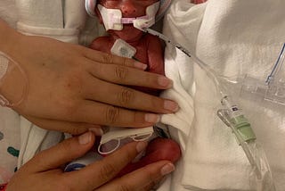 Felix’s Birth Story — HELLP syndrome and our little micro-preemie