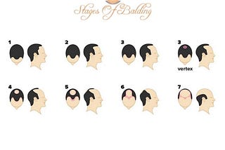 seven stages of balding