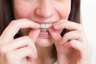 Transform Your Smile with Invisalign in Kennesaw: A Comprehensive Guide