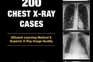 [DOWNLOAD]-200 Chest X-Ray Cases