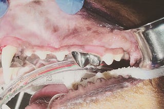 咬硬物造成牙齒斷裂