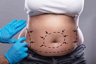 How is a Tummy Tuck Surgery Done