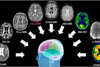 Brain Imaging and Model-Based Approaches to Perception: A Deep Dive into the Mind’s Eye