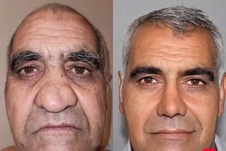 Iran’s Leading Cosmetic Surgeons: A Closer Look