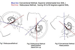 Comparison with Matsuzawa method and conventional imaging methods