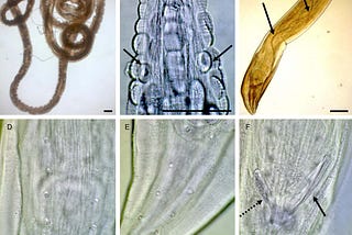 The Fascinating Plant Parasites —  Nematodes