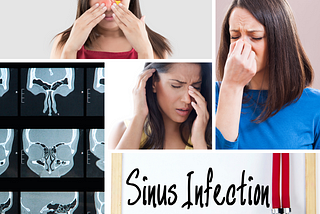 Sinus: causes and cure.