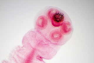 Five Parasites That Quietly Shaped Human History