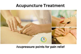 Best Acupuncture Treatment In Hyderabad | Acupuncturist