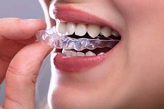 Everything You Need to Know About Orthodontic Treatment: Basics, Procedures and Benefits