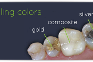 Tooth Jewelry (fillings) Types & Advantages | Tooth jewelry in delhi