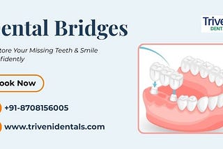 Dental Bridge