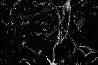Neurons in the brain of a mouse. Confocal microscope image.