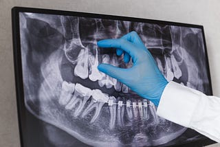 How often should you get dental x-rays?
