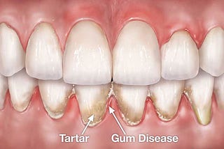 Nature’s Smile Review: A Closer Look At Natural Oral Health Solution