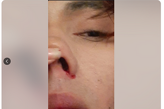 Italian-American actor, model and businessman Noah D’castellano was assaulted by a young man…