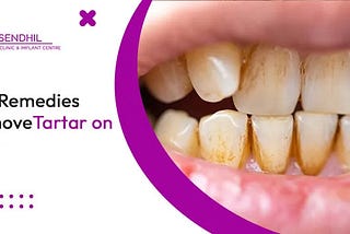 Home Remedies to Remove Tartar on teeth