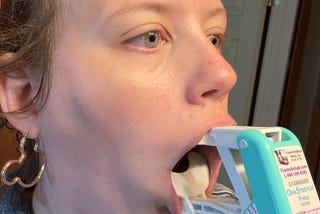8 Months Post-Op Jaw Surgery at The Piper Clinic