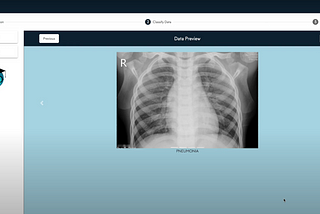 No-code AI for pediatric pneumonia detection