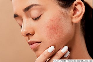 Skin Pigmentation Home Remedies