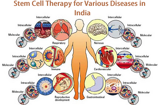 Best Stem Cell Therapy — Stem Cell Cure