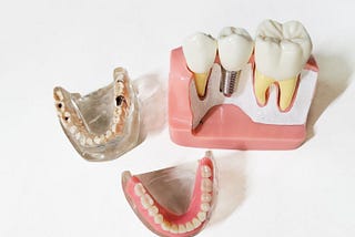dental implants and implant dentures