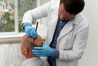 Hair Transplant Costs and Other Things You Need to Know
