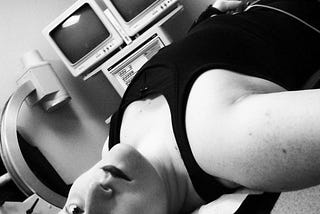 Black-and-white selfie of Alex lying on an exam table, a pair of gauze pads on their forehead with a small dot of blood at the centre of each. Behind Alex’s head, the metal arm of some kind of medical imaging tool arcs upward, toward a pair of bulky cathode ray tube monitors which are giving off that weird, distinctly clinical vibe of outdated futurism.
