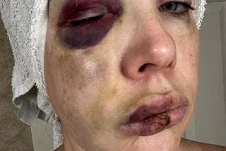 How Would You Answer, “Why do You Love me?”