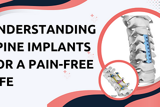 Understanding Spine Implants for a Pain-Free Life