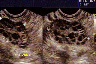 Understanding the Root Cause of Reproductive Misdiagnoses