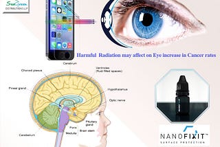 Radiation from mobiles may lead to brain damage:by sgdindia